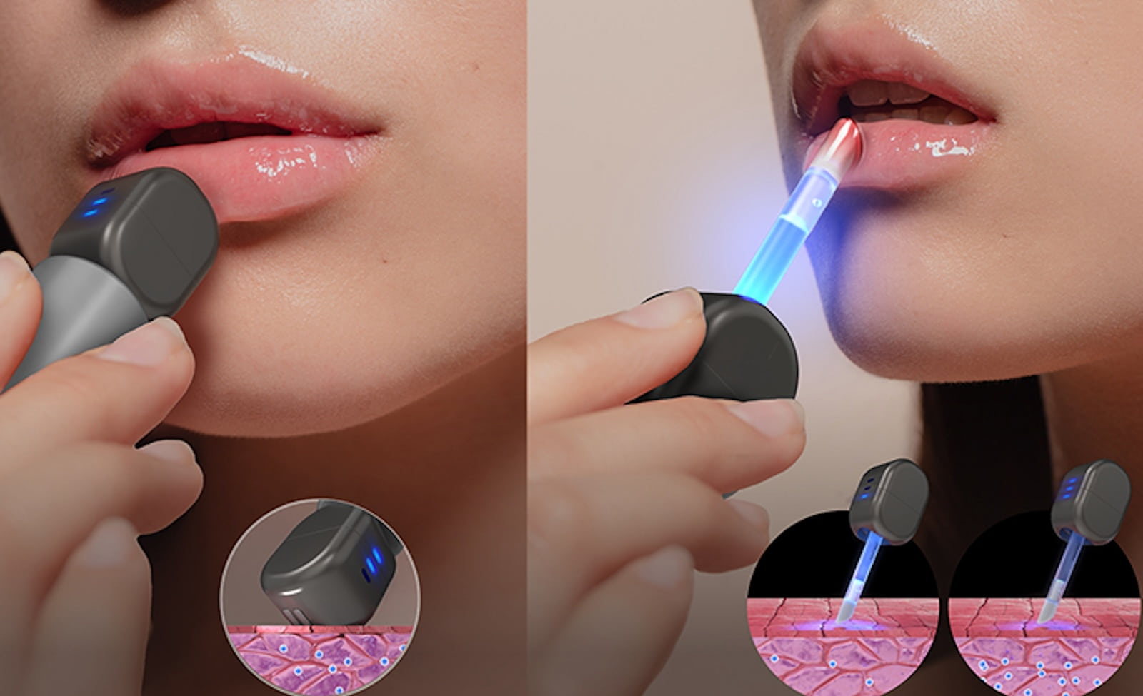 Amorepacific, Lipcure Beam